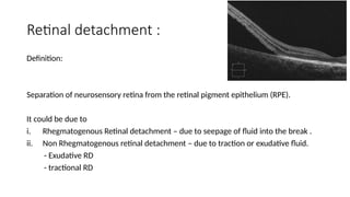 Retinal detachment for MBBS graduates.pptx
