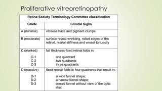 Proliferative vitreoretinopathy
 