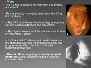 Tractional Rd Oct Retinal detachment | PPTX