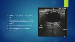 ORBIT -highly reflective due to orbital
fat.
 Always examine the other eye before
coming to a conclusion regarding the
lesion .
 Opacities produce dots or short lines
 Membranous lesions produce an
echogenic line
 