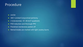 Procedure
 LA/GA
 360˚/ Limited Conjunctival peritomy
 3 Sclerotomies- ST, SN & IT quadrants
 PVD induction and thorough PPV
 Preretinal membranes peeled off
 Retinal breaks are marked with light cautery burns
 