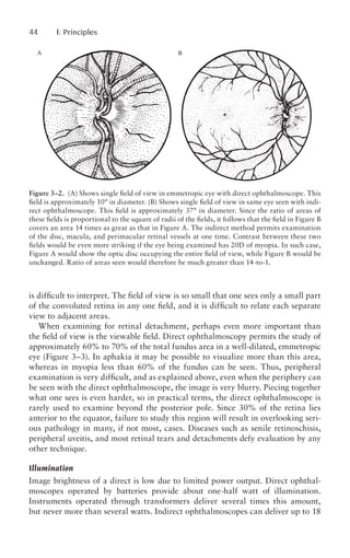Retinal Detachment Principles and Practice 3rd Ed.pdf
