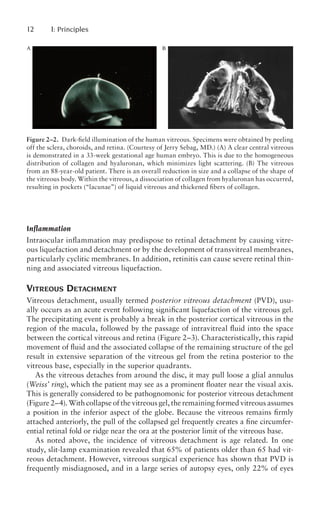 Jerry Sebag Retinal Detachment Principles and Practice 3rd Ed.pdf