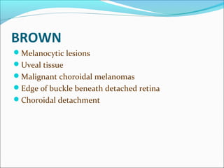 BROWN
Melanocytic lesions
Uveal tissue
Malignant choroidal melanomas
Edge of buckle beneath detached retina
Choroidal detachment
 