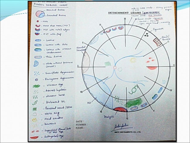 retinal diagram dr sabin sahu online draw on graph paper