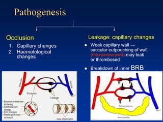 Pathogenesis
 Weak capillary wall →
saccular outpouching of wall
(microaneurysm)-may leak
or thrombosed
 Breakdown of inner BRB
Leakage: capillary changesOcclusion
1. Capillary changes
2. Haematological
changes
 