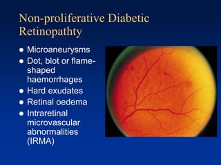 Non-proliferative Diabetic
Retinopathty
 Microaneurysms
 Dot, blot or flame-
shaped
haemorrhages
 Hard exudates
 Retinal oedema
 Intraretinal
microvascular
abnormalities
(IRMA)
 