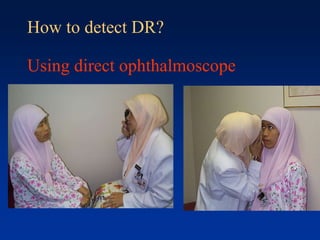 How to detect DR?
Using direct ophthalmoscope
 