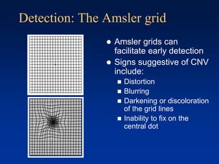 Detection: The Amsler grid
 Amsler grids can
facilitate early detection
 Signs suggestive of CNV
include:
 Distortion
 Blurring
 Darkening or discoloration
of the grid lines
 Inability to fix on the
central dot
 