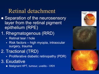 Retinal detachment
 Separation of the neurosensory
layer from the retinal pigment
epithelium (RPE)
1. Rhegmatogenous (RRD)
 Retinal tear / hole
 Risk factors – high myopia, intraocular
surgery, trauma
2. Tractional (TRD)
 Proliferative diabetic retinopathy (PDR)
3. Exudative
 Malignant HPT, tumour, uveitis - VKH
 