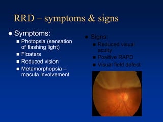 RRD – symptoms & signs
 Signs:
 Reduced visual
acuity
 Positive RAPD
 Visual field defect
 Symptoms:
 Photopsia (sensation
of flashing light)
 Floaters
 Reduced vision
 Metamorphopsia –
macula involvement
 