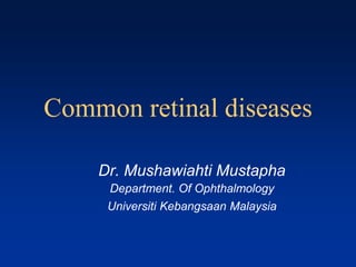 Common retinal diseases
Dr. Mushawiahti Mustapha
Department. Of Ophthalmology
Universiti Kebangsaan Malaysia
 