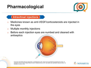 Retinal disorders DME | PPTX