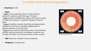 Snowflake Disorder Retinal dystrophy | PPTX