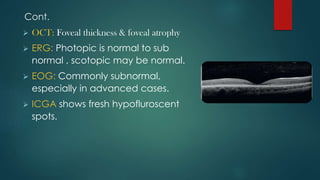 Retinal Dystrophy. Farhad - Copy.pptx