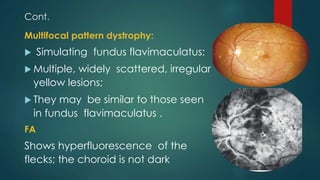 Retinal Dystrophy. Farhad - Copy.pptx