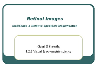 Retinal Images   Size/Shape & Relative Spectacle Magnification   Gauri S Shrestha 1.2.2 Visual & optometric science  