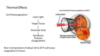 Thermal Effects
(1) Photocoagulation:
Laser Light
Target Tissue
Generate Heat
Denatures
Proteins
(Coagulation)
Rise in temperature of about 10 to 20 0C will cause
coagulation of tissue.
 
