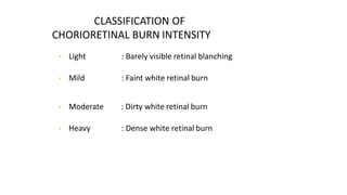 CLASSIFICATION OF
CHORIORETINAL BURN INTENSITY
• Light
• Mild
: Barely visible retinal blanching
: Faint white retinal burn
• Moderate : Dirty white retinal burn
• Heavy : Dense white retinal burn
 