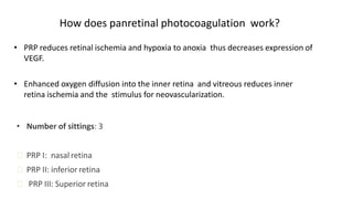 How does panretinal photocoagulation work?
• PRP reduces retinal ischemia and hypoxia to anoxia thus decreases expression of
VEGF.
• Enhanced oxygen diffusion into the inner retina and vitreous reduces inner
retina ischemia and the stimulus for neovascularization.
• Number of sittings: 3
ꟷ PRP I: nasal retina
ꟷ PRP II: inferior retina
ꟷ PRP III: Superior retina
 