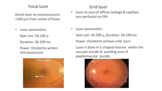 Focal laser
Direct laser to microaneurysm
>500 μm from centre of fovea
• Laser parameters:
ꟷ Spot size: 50-100 μ
ꟷ Duration: 50-100 ms
ꟷ Power- titrated to whiten
microaneurysm
Grid laser
• Laser to area of diffuse leakage & capillary
non-perfusion on FFA
• Laser parameters:
ꟷ Spot size: 50-200 μ, Duration: 50-100 ms
ꟷ Power: titrated to achieve mild burn
ꟷ Laser is done in C-shaped manner within the
vascular arcade & avoiding area of
papillomacular bundle
 