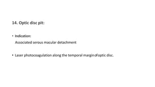 14. Optic disc pit:
• Indication:
Associated serous macular detachment
• Laser photocoagulation along the temporal marginofoptic disc.
 