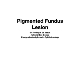 Pigmented Fundus
Lesion
dr. Frenky R. de Jesus
National Eye Centre
Postgraduate diploma in Ophthalmology
 