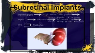 Light-sensitive photodiode
Bipolar cells
Amacrine cells
Horizontal cells
electrical
signals
Amplifier Electrode
RGC Thalamus
graded
potentials
action
potentials
...