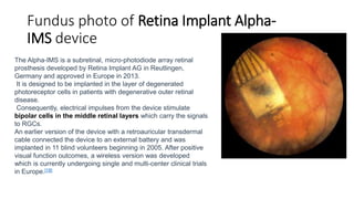 Fundus photo of Retina Implant Alpha-
IMS device
The Alpha-IMS is a subretinal, micro-photodiode array retinal
prosthesis developed by Retina Implant AG in Reutlingen,
Germany and approved in Europe in 2013.
It is designed to be implanted in the layer of degenerated
photoreceptor cells in patients with degenerative outer retinal
disease.
Consequently, electrical impulses from the device stimulate
bipolar cells in the middle retinal layers which carry the signals
to RGCs.
An earlier version of the device with a retroauricular transdermal
cable connected the device to an external battery and was
implanted in 11 blind volunteers beginning in 2005. After positive
visual function outcomes, a wireless version was developed
which is currently undergoing single and multi-center clinical trials
in Europe.[18]
 