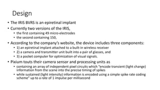 Design
• The IRIS BVRS is an epiretinal implant
• Currently two versions of the IRIS,
• the first containing 49 micro-electrodes
• the second containing 150,
• According to the company’s website, the device includes three components:
• 1) an epiretinal implant attached to a built-in wireless receiver
• 2) a camera and transmitter unit built into a pair of glasses, and
• 3) a pocket computer for optimization of visual signals.
• Pixium touts their camera sensor and processing units as
• containing an array of independent pixel circuits which “encode transient (light change)
information from the scene into the precise timing of spikes
• while sustained (light intensity) information is encoded using a simple spike rate coding
scheme” up to a rate of 1 impulse per millisecond
 