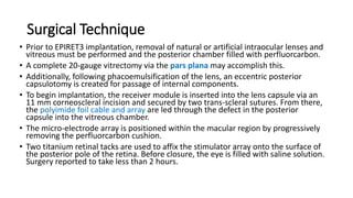 Surgical Technique
• Prior to EPIRET3 implantation, removal of natural or artificial intraocular lenses and
vitreous must be performed and the posterior chamber filled with perfluorcarbon.
• A complete 20-gauge vitrectomy via the pars plana may accomplish this.
• Additionally, following phacoemulsification of the lens, an eccentric posterior
capsulotomy is created for passage of internal components.
• To begin implantation, the receiver module is inserted into the lens capsule via an
11 mm corneoscleral incision and secured by two trans-scleral sutures. From there,
the polyimide foil cable and array are led through the defect in the posterior
capsule into the vitreous chamber.
• The micro-electrode array is positioned within the macular region by progressively
removing the perfluorcarbon cushion.
• Two titanium retinal tacks are used to affix the stimulator array onto the surface of
the posterior pole of the retina. Before closure, the eye is filled with saline solution.
Surgery reported to take less than 2 hours.
 
