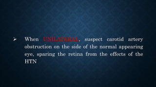  When UNILATERAL, suspect carotid artery
obstruction on the side of the normal appearing
eye, sparing the retina from the effects of the
HTN
 