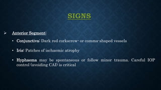 SIGNS
 Anterior Segment:
• Conjunctiva: Dark red corkscrew- or comma-shaped vessels
• Iris: Patches of ischaemic atrophy
• Hyphaema may be spontaneous or follow minor trauma. Careful IOP
control (avoiding CAI) is critical
 