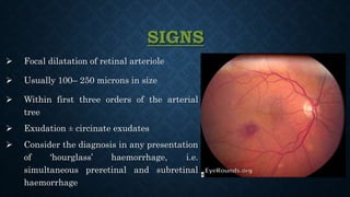  Focal dilatation of retinal arteriole
 Usually 100– 250 microns in size
 Within first three orders of the arterial
tree
 Exudation ± circinate exudates
 Consider the diagnosis in any presentation
of ‘hourglass’ haemorrhage, i.e.
simultaneous preretinal and subretinal
haemorrhage
SIGNS
 