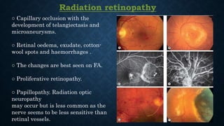 Radiation retinopathy
○ Capillary occlusion with the
development of telangiectasis and
microaneurysms.
○ Retinal oedema, exudate, cotton-
wool spots and haemorrhages .
○ The changes are best seen on FA.
○ Proliferative retinopathy.
○ Papillopathy. Radiation optic
neuropathy
may occur but is less common as the
nerve seems to be less sensitive than
retinal vessels.
 