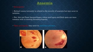 Anaemia
• Retinopathy:
○ Retinal venous tortuosity is related to the severity of anaemia but may occur in
isolation.
○ Dot, blot and flame haemorrhages, cotton-wool spots and Roth spots are more
common with co-existing thrombocytopenia.
• Optic neuropathy may occur in pernicious anaemia.
 