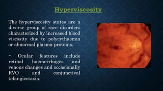 Hyperviscosity
The hyperviscosity states are a
diverse group of rare disorders
characterized by increased blood
viscosity due to polycythaemia
or abnormal plasma proteins.
• Ocular features include
retinal haemorrhages and
venous changes and occasionally
RVO and conjunctival
telangiectasia.
 