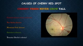 CAUSES OF CHERRY RED SPOT
CHERRY TREES NEVER GROW TALL
Central retinal artery occlusion
Tay-Sachs disease
Niemann-Pick disease
Gaucher's disease
Trauma (Berlin's edema)
 