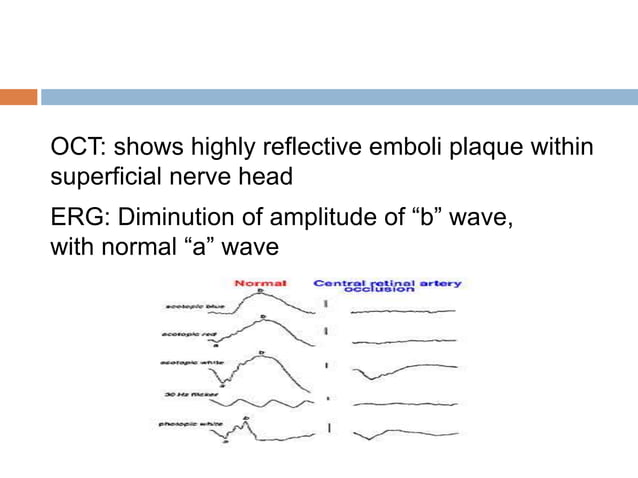 Retinal vascular occlusions | PPTX
