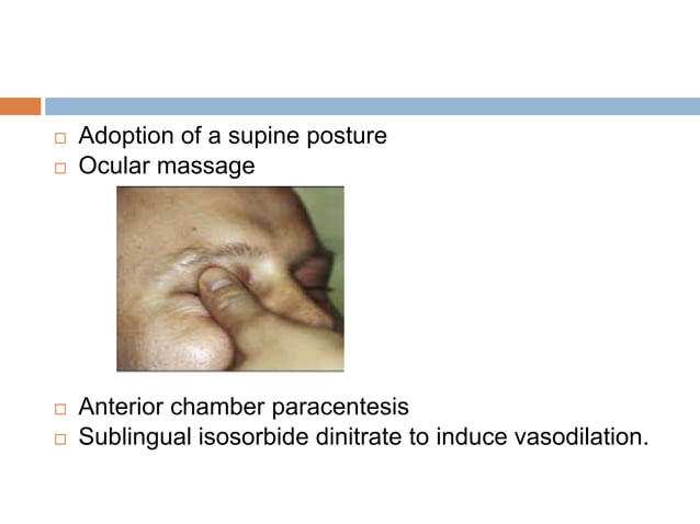 Retinal vascular occlusions | PPTX
