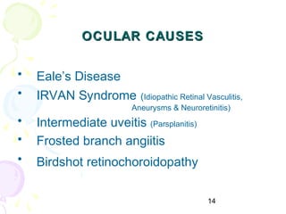 14
OCULAR CAUSESOCULAR CAUSES
• Eale’s Disease
• IRVAN Syndrome (Idiopathic Retinal Vasculitis,
Aneurysms & Neuroretinitis)
• Intermediate uveitis (Parsplanitis)
• Frosted branch angiitis
• Birdshot retinochoroidopathy
 