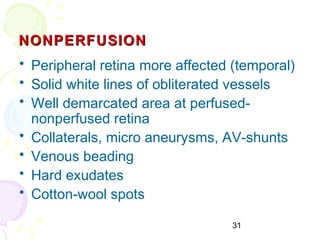 31
NONPERFUSIONNONPERFUSION
• Peripheral retina more affected (temporal)
• Solid white lines of obliterated vessels
• Well demarcated area at perfused-
nonperfused retina
• Collaterals, micro aneurysms, AV-shunts
• Venous beading
• Hard exudates
• Cotton-wool spots
 