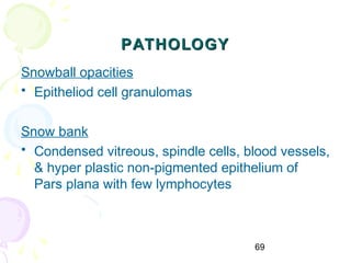 69
PATHOLOGYPATHOLOGY
Snowball opacities
• Epitheliod cell granulomas
Snow bank
• Condensed vitreous, spindle cells, blood vessels,
& hyper plastic non-pigmented epithelium of
Pars plana with few lymphocytes
 