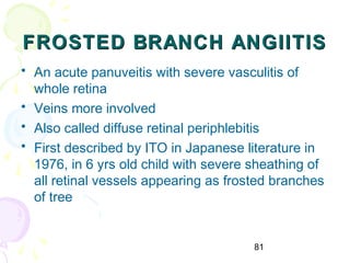 81
FROSTED BRANCH ANGIITISFROSTED BRANCH ANGIITIS
• An acute panuveitis with severe vasculitis of
whole retina
• Veins more involved
• Also called diffuse retinal periphlebitis
• First described by ITO in Japanese literature in
1976, in 6 yrs old child with severe sheathing of
all retinal vessels appearing as frosted branches
of tree
 