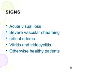 86
SIGNSSIGNS
• Acute visual loss
• Severe vascular sheathing
• retinal edema
• Vitritis and iridocyclitis
• Otherwise healthy patients
 