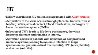 Mostly vasculitis in HIV patients is associated with CMV retinitis.
Acquisition of the virus occurs through placental transfer, breast
feeding, saliva, sexual contact, blood transfusions, and organ or
bone marrow transplants (BMTs).
Infection of CMV leads to life-long persistence, the virus
becomes dormant and remains in latency.
Activation occurs in patients with immature or compromised
immune systems, leading to systemic infection of lungs
(pneumonitis), gastrointestinal tract (colitis), CNS (encephalitis),
and retina (retinitis).
 
