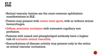 Retinal vascular lesions are the most common ophthalmic
manifestations in SLE.
Patient may present with cotton wool spots, with or without retinal
hemorrhages.
Diffuse arteriolar occlusion with extensive capillary non
perfusion.
Patients with raised anti-phospholipid antibody have a higher
risk of occlusive retinal vasculitis.
Exacerbations of disease activity may present only in the retina
as retinal vascular occlusions.
 