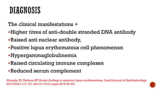 The clinical manifestations +
Higher titres of anti-double stranded DNA antibody
Raised anti nuclear antibody,
Positive lupus erythematous cell phenomenon
Hypergammaglobulinemia
Raised circulating immune complexes
Reduced serum complement
Shoughy SS,Tabbara KF. Ocular findings in systemic lupus erythematosus.Saudi Journal of Ophthalmology.
2016;30(2):117-121.doi:10.1016/j.sjopt.2016.02.001.
 