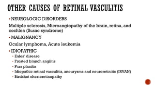 NEUROLOGIC DISORDERS
Multiple sclerosis, Microangiopathy of the brain, retina, and
cochlea (Susac syndrome)
MALIGNANCY
Ocular lymphoma, Acute leukemia
IDIOPATHIC
• Eales’ disease
• Frosted branch angiitis
• Pars planitis
• Idiopathic retinal vasculitis, aneurysms and neuroretinitis (IRVAN)
• Birdshot chorioretinopathy
 