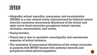 Idiopathic retinal vasculitis, aneurysms, and neuroretinitis
(IRVAN) is a rare clinical entity characterized by bilateral retinal
arteritis, numerous aneurysmal dilatations of the retinal and
optic nerve head arterioles, peripheral retinal vascular
occlusion, neuroretinitis, and uveitis.
Young females.
Visual loss is due to exudative maculopathy and neovascular
sequelae of retinal ischemia.
The resolution of aneurysmal dilatations of the retinal arterioles
in patients with IRVAN treated with systemic steroids and
peripheral retinal photocoagulation.
 